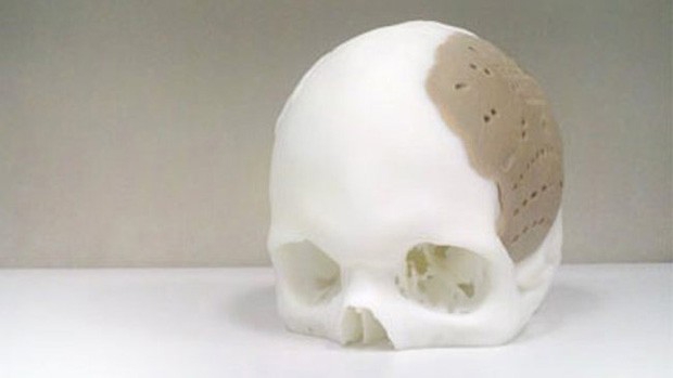 3D печать. Искусственный череп.